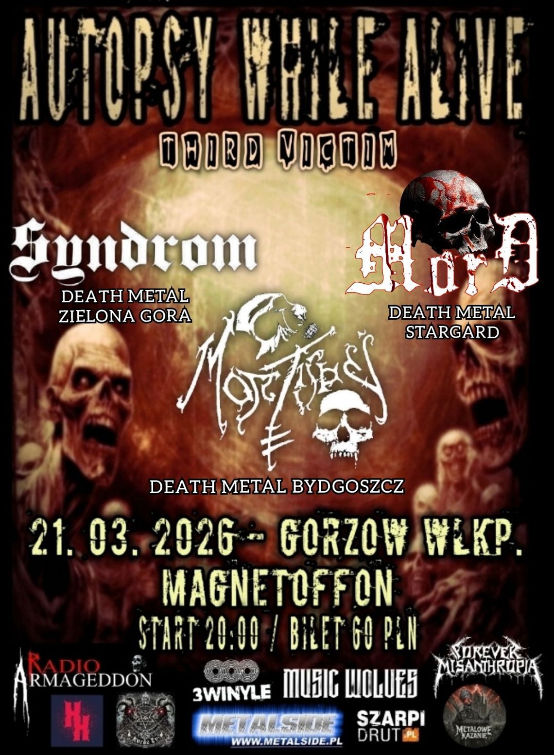 Autopsy While Alive - koncert