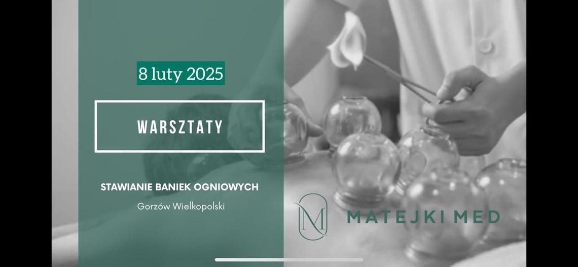 Warsztaty ze stawiania baniek ogniowych - kurs dla początkujących Warsztaty ze stawiania baniek ogniowych - kurs dla początkujących